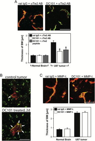 Vascular normalization governs brain tumor response to radiation