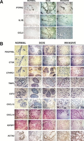 Microenvironmental changes during breast tumor progression
