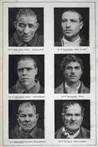 Lavater Suggests a Link Between Physical Traits and Criminality