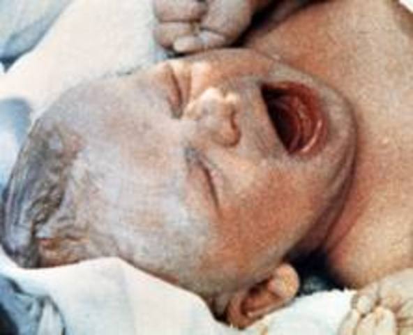 First Test Tube Baby Born