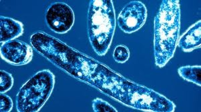 Legionnaires Disease