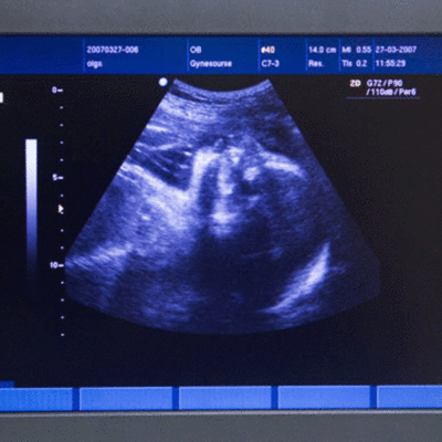 Timeline: ETAPAS IMPORTANTES DE MI VIDA