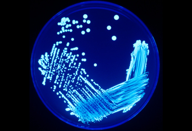 Legionnaire’s disease workcited