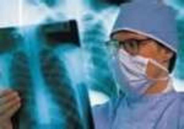 Legionnaire’s disease strikes 182, kills 29