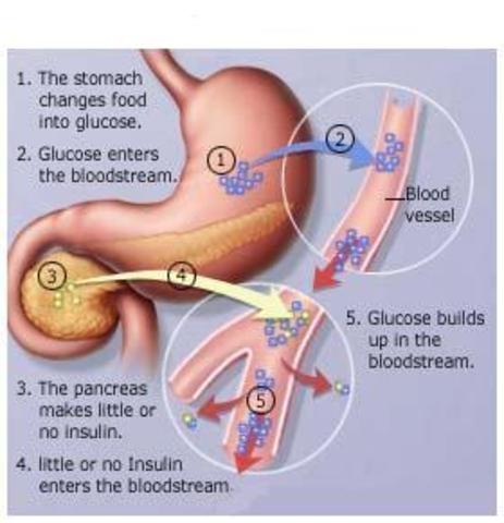 Insulin