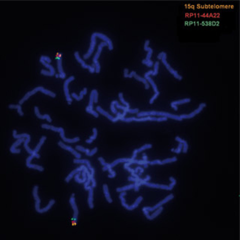 Primer Diagnostico Prenatal