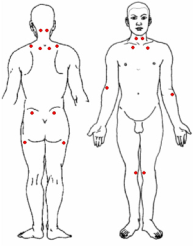Empleamiento de Inteferentes