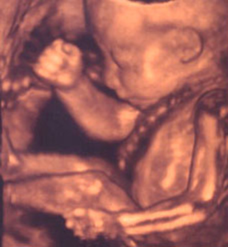 I am able to recognize voices (Psychosocial)