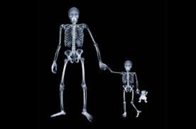 Medical Use of X-Rays