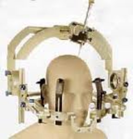 Stereotactic Method