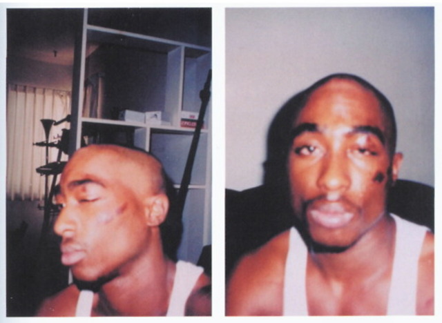 Lawsuit over alleged police brutality