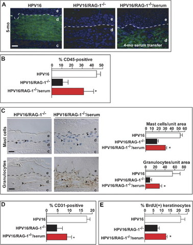 B cells foster squamous carcinogenesis