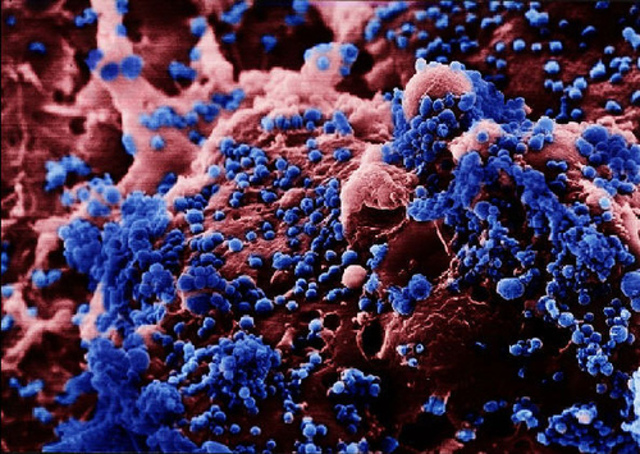 H5N1 is reported to have killed an additional three people in Vietnam.