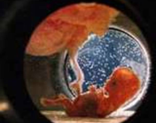 First Test-Tube Baby