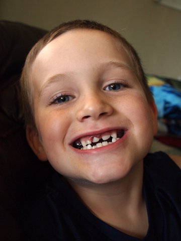 Fudge try to be a bird but loses his to front teeth trying to.