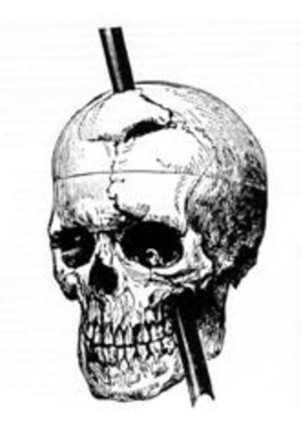 El Dolor de cabeza de Phineas Gage