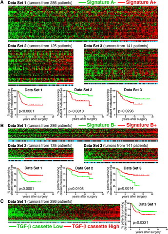 Molecular definition of breast tumor heterogeneity