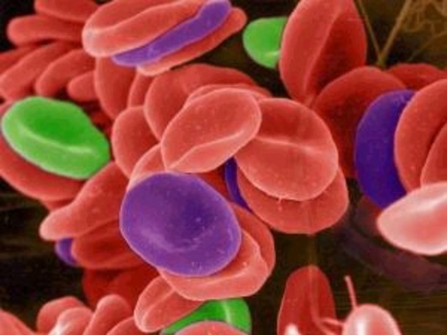 Karl Landsteiner Discovered the Blood types.