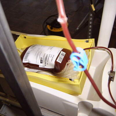 Timeline: If the blood transfusion hadn't invented