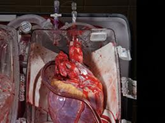 First Human Heart Transplant