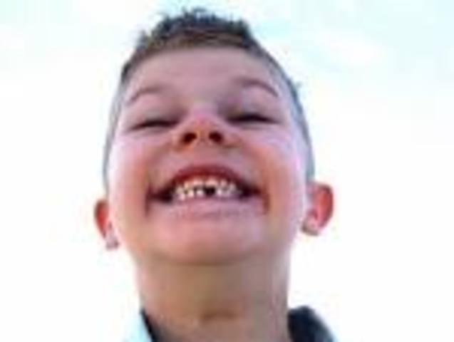 Lost First Tooth