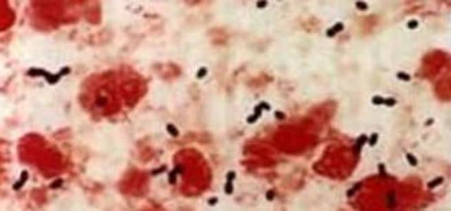 Descubrimiento de la transformacion en neumococos