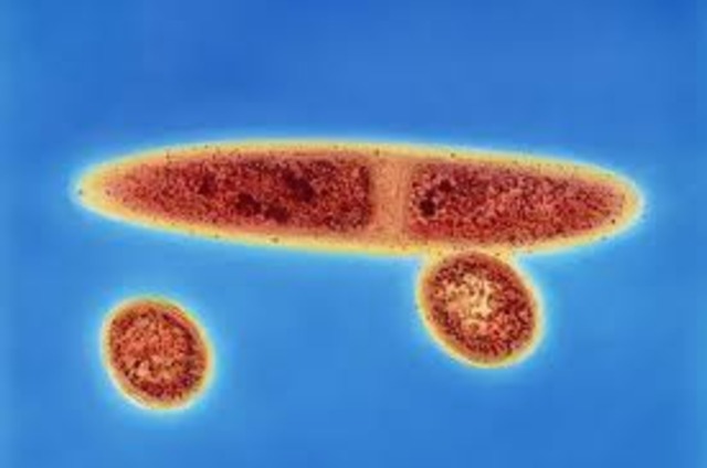 Descubrimiento de archea