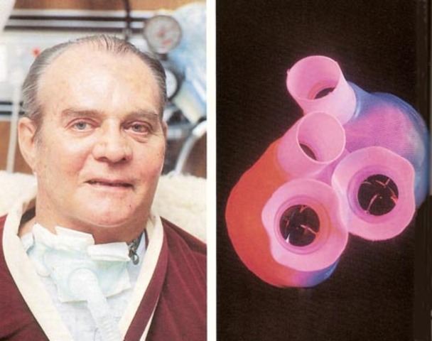 Science and Tecnology: The First Artificial Heart Implanted