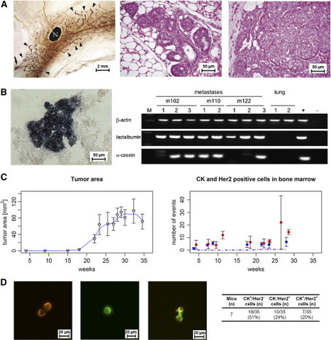 Systemic spread in an early step in breast cancer