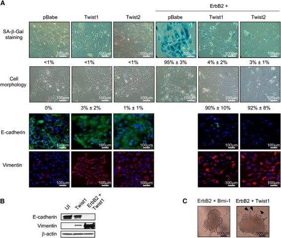 Inhibition of premature senescence by Twist