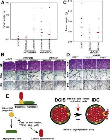 Myoepithelial control of breast tumor progression