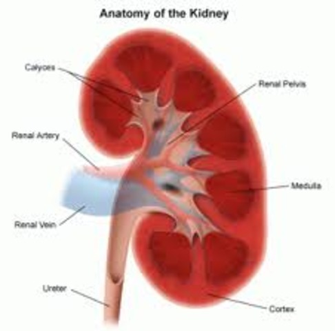 artificial kidney