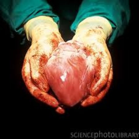 first heart transplant in South Africa.