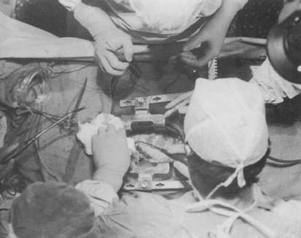 sciene and tech; first sucsesful open heart surgery