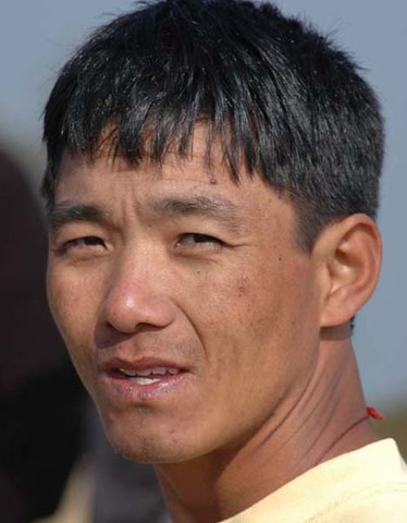 Nawang nailed by severe bout of edema