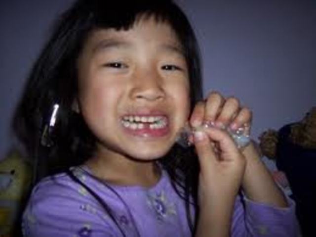 Lost my first tooth