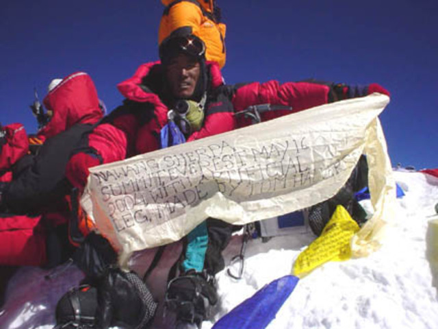 Nawang has trouble walking.