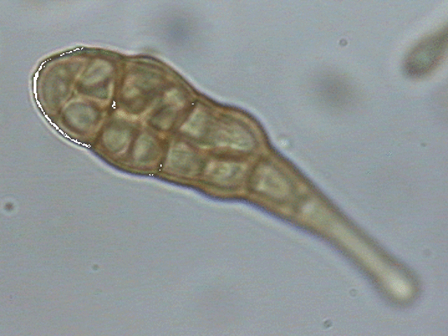 primeras celulas con nucleo