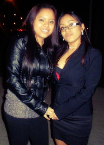 My sister diagnosed with Lupus