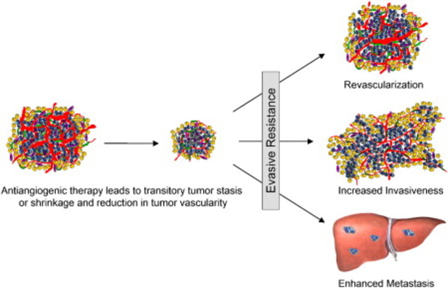 Malignant progression in angiogenesis inhibition