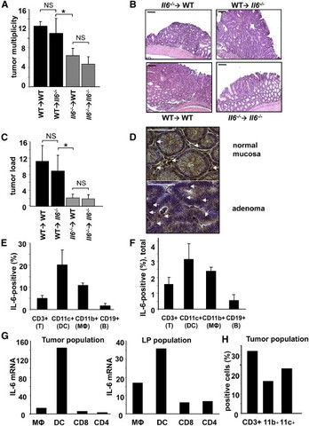 IL-6-Stat3 signaling in colitis-associated cancer