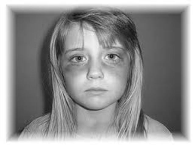 Child Abuse