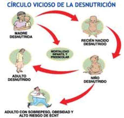 DESNUTRICION