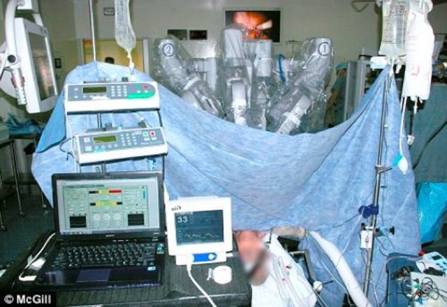 First Robotic Surgery