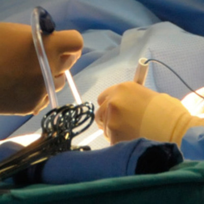 Timeline: Technological Advances in Organ Transplantation