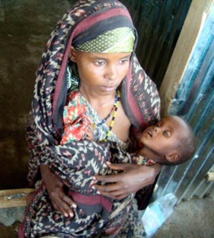 desnutricion en colombia