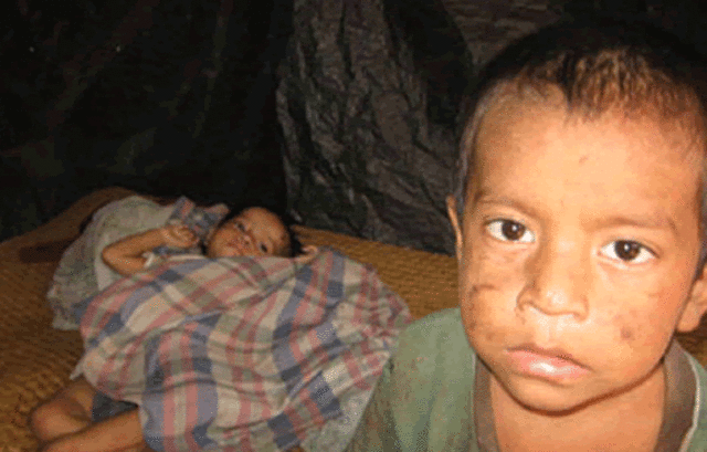 la desnutricion actual