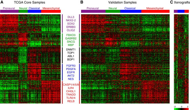 Genomic Alterations in Clinical GBM Subtypes