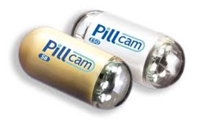 Pill camera was used