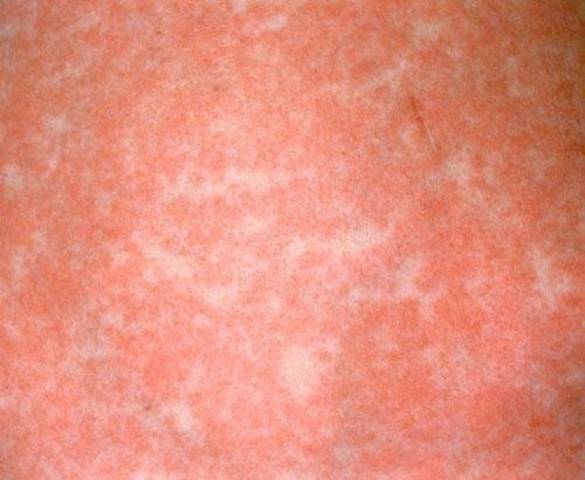 Rising Action: Conlfict